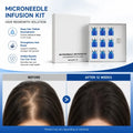 Everlisse Copper Micro-Infusion Kit